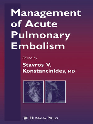 cover image of Management of Acute Pulmonary Embolism